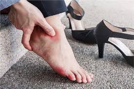 عضة الحذاء.. 5 علاجات طبيعية تعالج جروح القدمين