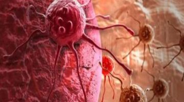 دراسة جديدة.. تأثير وباء كورونا على تأخر فحص السرطان