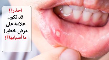 احذر.. تقرحات الفم قد تشير إلى الإصابة بمرض خطير.. تعرف عليها قبل فوات الأوان!!